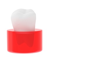 歯周病の治療と予防